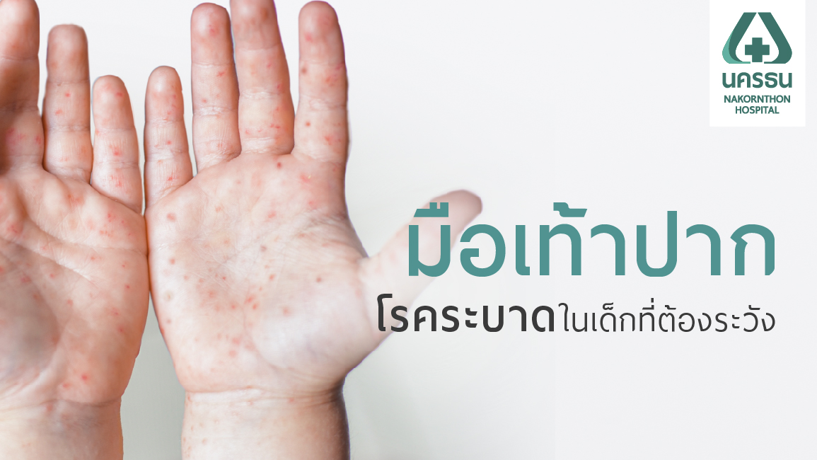 ‘มือเท้าปาก’ โรคที่พบมากในเด็กเล็ก ติดต่อง่าย มีวัคซีนป้องกัน!